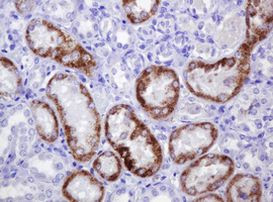 AMACR Antibody in Immunohistochemistry (Paraffin) (IHC (P))