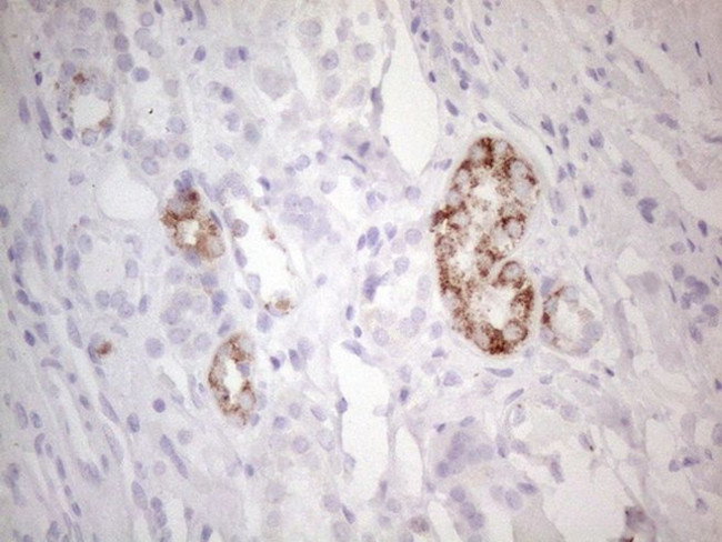 AMACR Antibody in Immunohistochemistry (Paraffin) (IHC (P))
