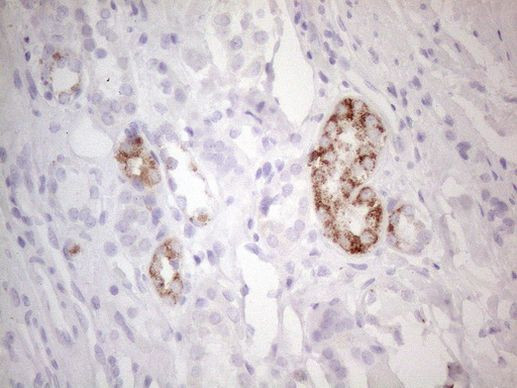 AMACR Antibody in Immunohistochemistry (Paraffin) (IHC (P))