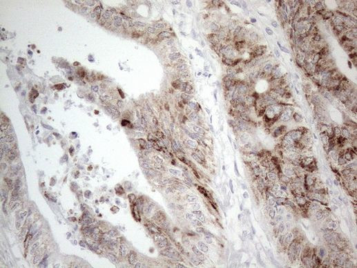 AMACR Antibody in Immunohistochemistry (Paraffin) (IHC (P))