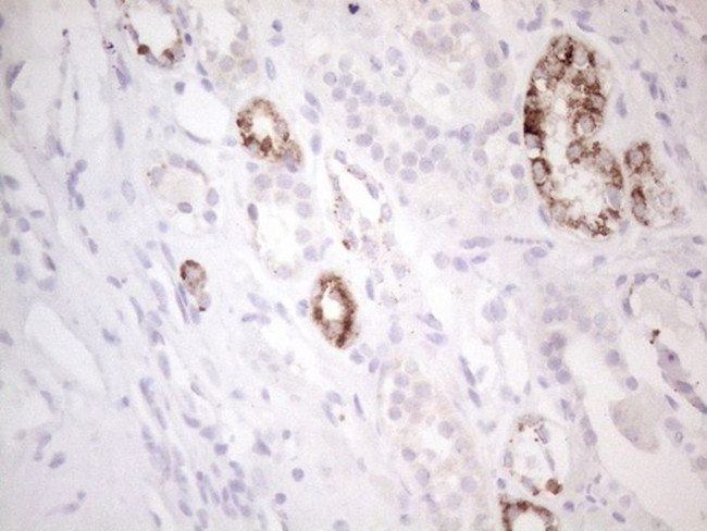 AMACR Antibody in Immunohistochemistry (Paraffin) (IHC (P))