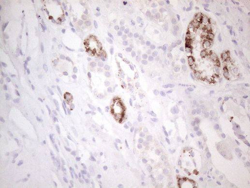 AMACR Antibody in Immunohistochemistry (Paraffin) (IHC (P))