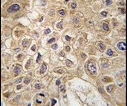 AMFR Antibody in Immunohistochemistry (IHC)