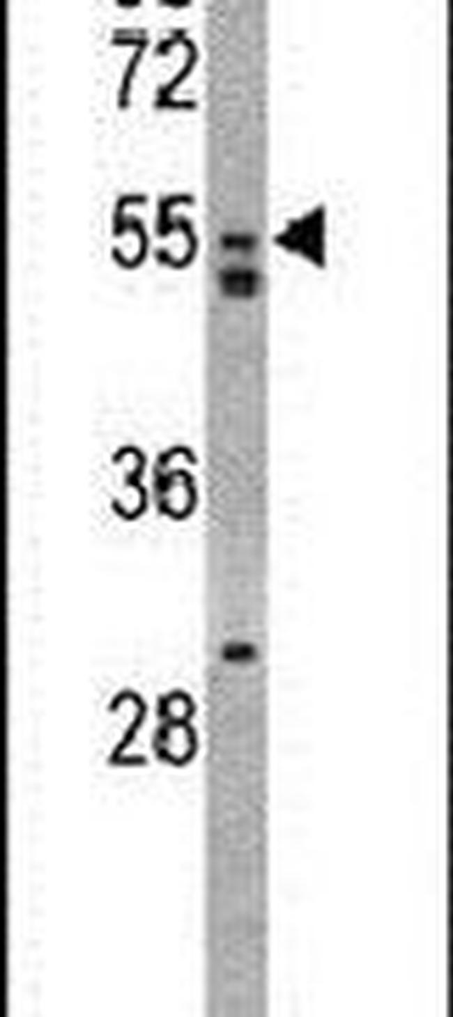 AMHR2 Antibody in Western Blot (WB)