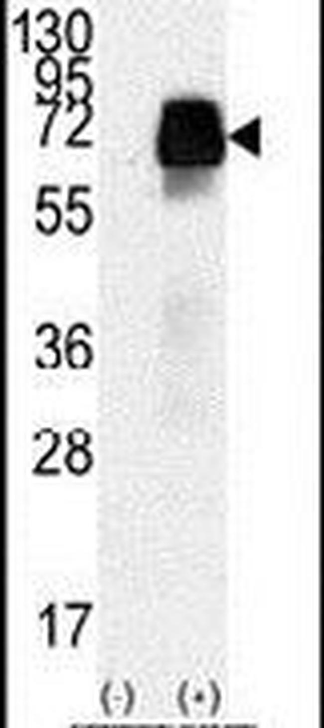 AMHR2 Antibody in Western Blot (WB)