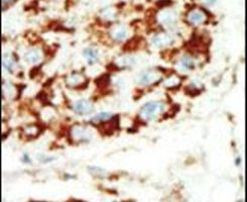 AMPK beta-1 Antibody in Immunohistochemistry (IHC)