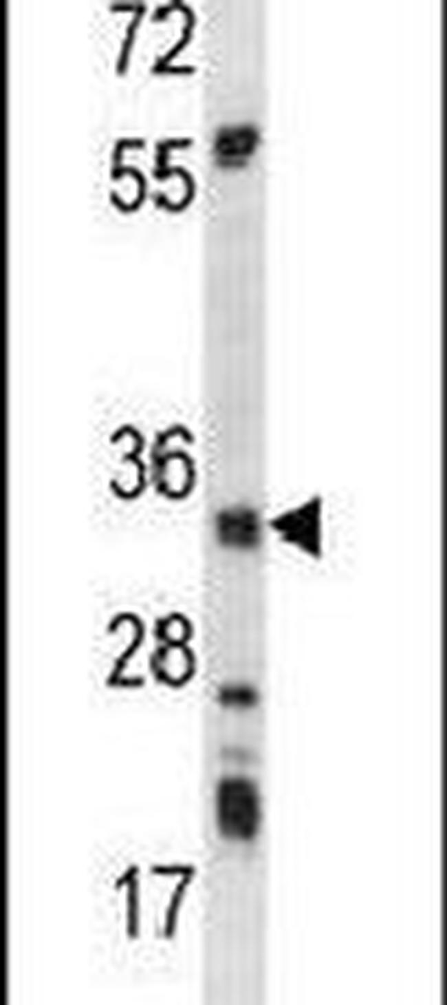 AMPK beta-2 Antibody in Western Blot (WB)