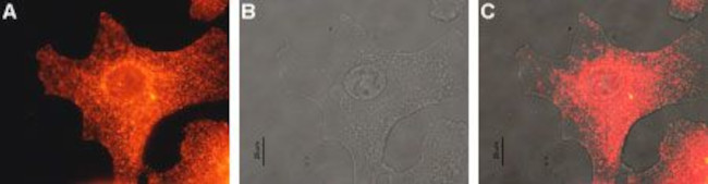 MC1 Receptor Antibody in Immunocytochemistry (ICC/IF)