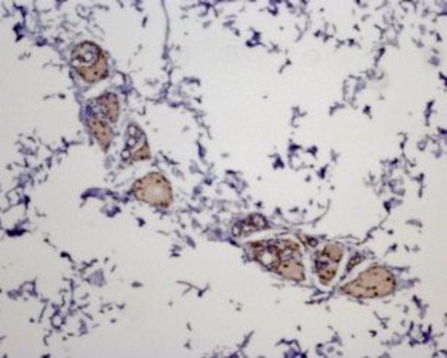 MC5 Receptor Antibody in Immunohistochemistry (Paraffin) (IHC (P))