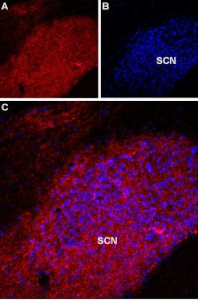 Melatonin Receptor 1A (MTNR1A) Antibody in Immunohistochemistry (IHC)