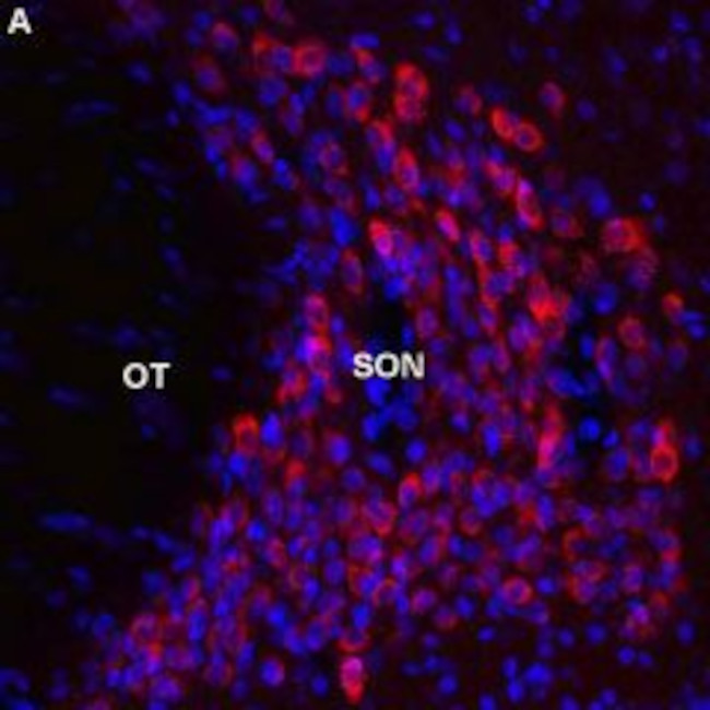 Melatonin Receptor 1B (MTNR1B) Antibody in Immunohistochemistry (Frozen) (IHC (F))
