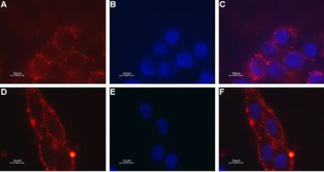 MCHR1 (extracellular) Antibody in Immunocytochemistry (ICC/IF)