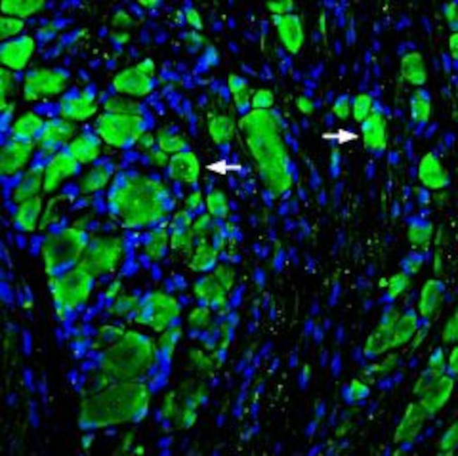 MRGPRD (GPCR TGR7) Antibody in Immunohistochemistry (IHC)