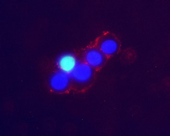 Noradrenaline Transporter (NET) (extracellular) Antibody in Immunocytochemistry (ICC/IF)