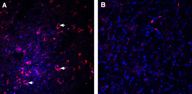 Dopamine Transporter (DAT) (extracellular) Antibody in Immunohistochemistry (Frozen) (IHC (F))