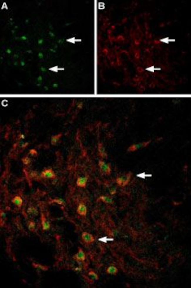 VMAT2 Antibody in Multiplex Immunohistochemistry (mIHC)