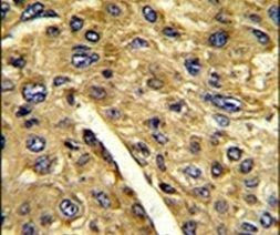 AMT Antibody in Immunohistochemistry (IHC)