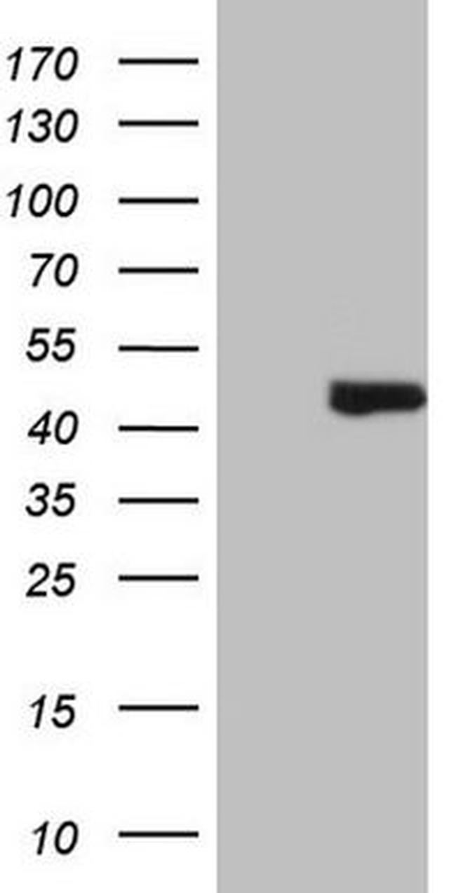 AMT Antibody in Western Blot (WB)