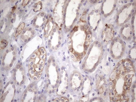 AMTN Antibody in Immunohistochemistry (Paraffin) (IHC (P))