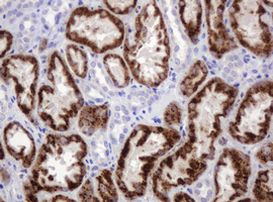 AMY2B Antibody in Immunohistochemistry (Paraffin) (IHC (P))