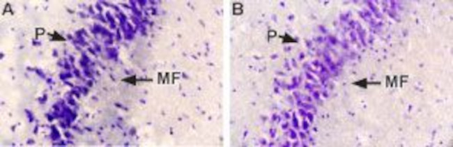 NGF Antibody in Immunohistochemistry (IHC)