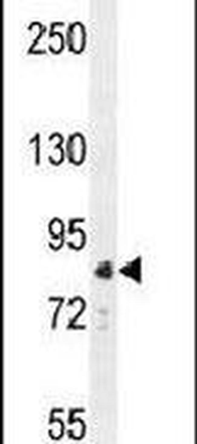 APC5 Antibody in Western Blot (WB)