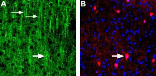 Nicotinic Acetylcholine Receptor alpha 3 (CHRNA3) (extracellular) Antibody in Immunohistochemistry (Frozen) (IHC (F))