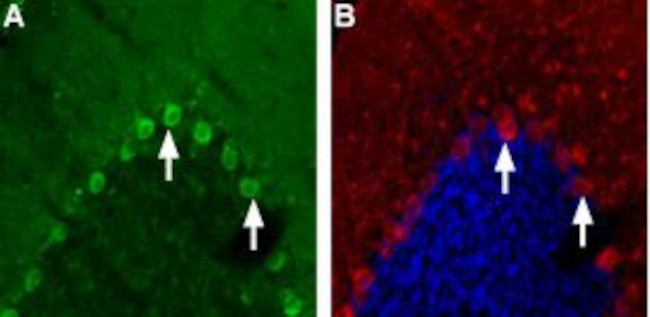 Nicotinic Acetylcholine Receptor alpha 4 (CHRNA4) (extracellular) Antibody in Immunohistochemistry (Frozen) (IHC (F))