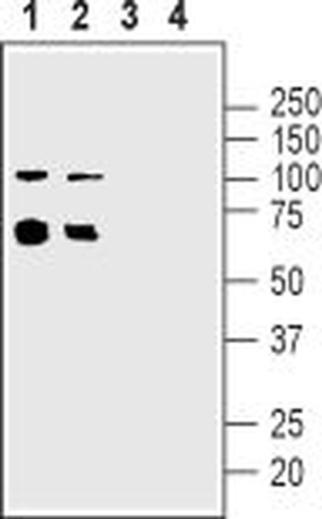 Nicotinic Acetylcholine Receptor alpha 5 (CHRNA5) (extracellular) Antibody in Western Blot (WB)