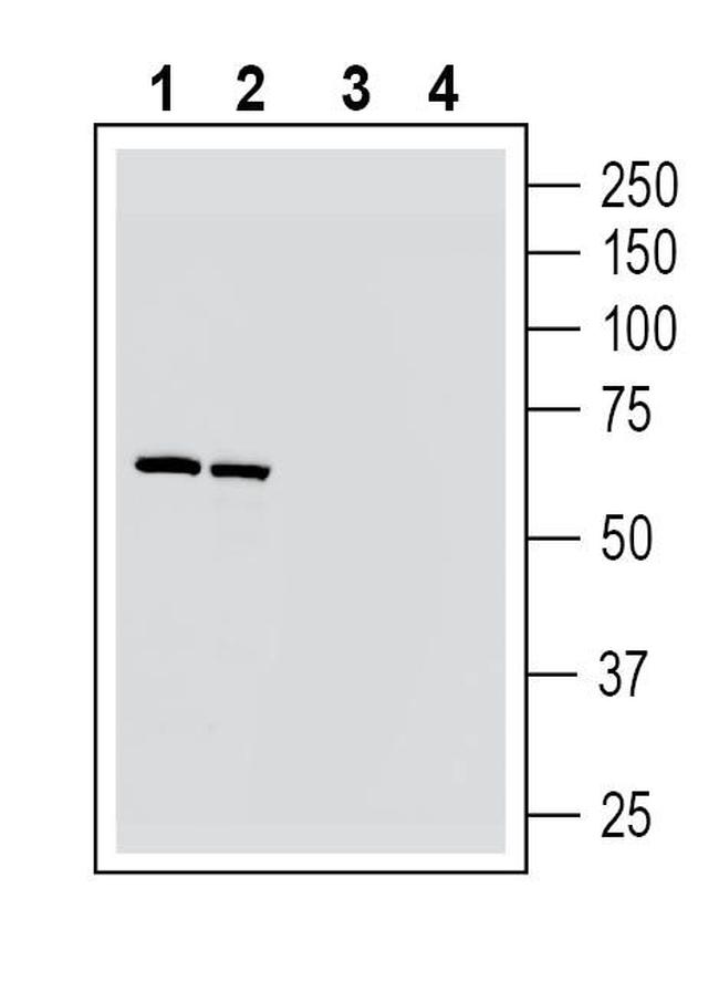 Nicotinic Acetylcholine Receptor alpha 6 (CHRNA6) (extracellular) Antibody in Western Blot (WB)