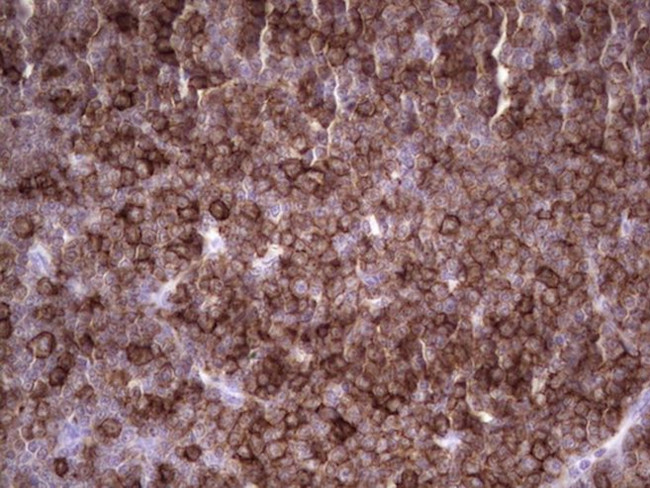 ANGPTL1 Antibody in Immunohistochemistry (Paraffin) (IHC (P))