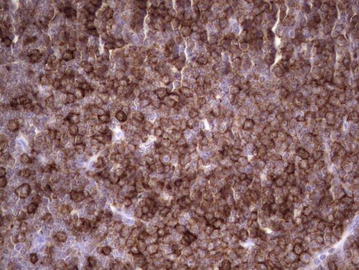 ANGPTL1 Antibody in Immunohistochemistry (Paraffin) (IHC (P))