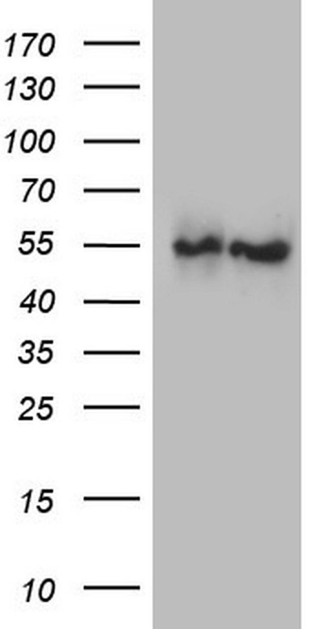 ANGPTL1 Antibody in Western Blot (WB)