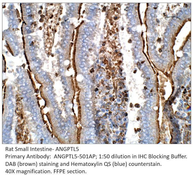 ANGPTL5 Antibody in Immunohistochemistry (IHC)