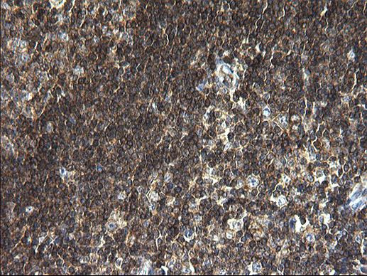 ANKMY2 Antibody in Immunohistochemistry (Paraffin) (IHC (P))