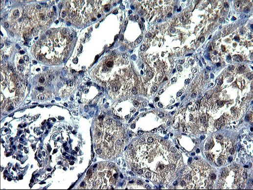 ANKMY2 Antibody in Immunohistochemistry (Paraffin) (IHC (P))