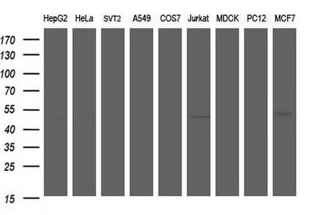 ANKMY2 Antibody in Western Blot (WB)