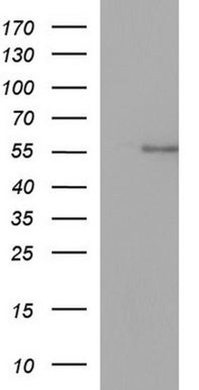 ANKMY2 Antibody in Western Blot (WB)