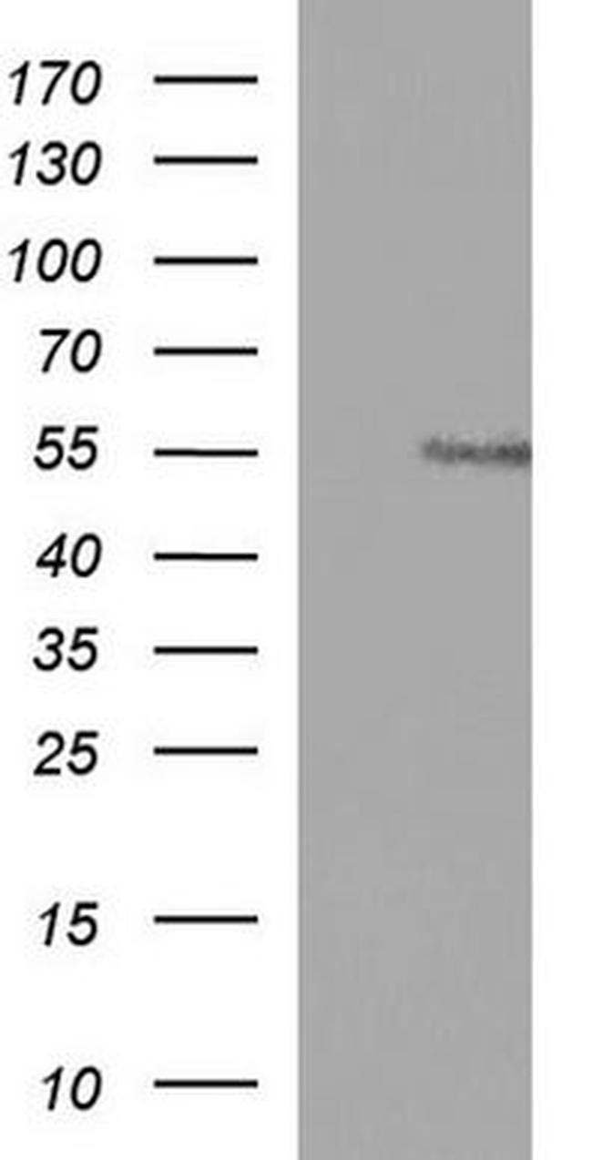 ANKMY2 Antibody in Western Blot (WB)