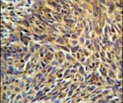 ANKRD32 Antibody in Immunohistochemistry (IHC)