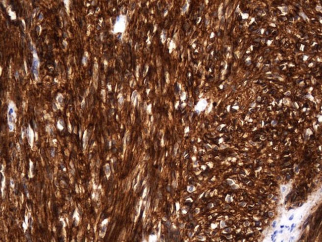 ANO1 Antibody in Immunohistochemistry (Paraffin) (IHC (P))