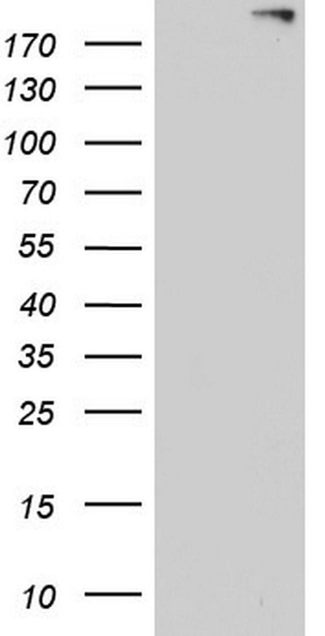 ANO1 Antibody in Western Blot (WB)