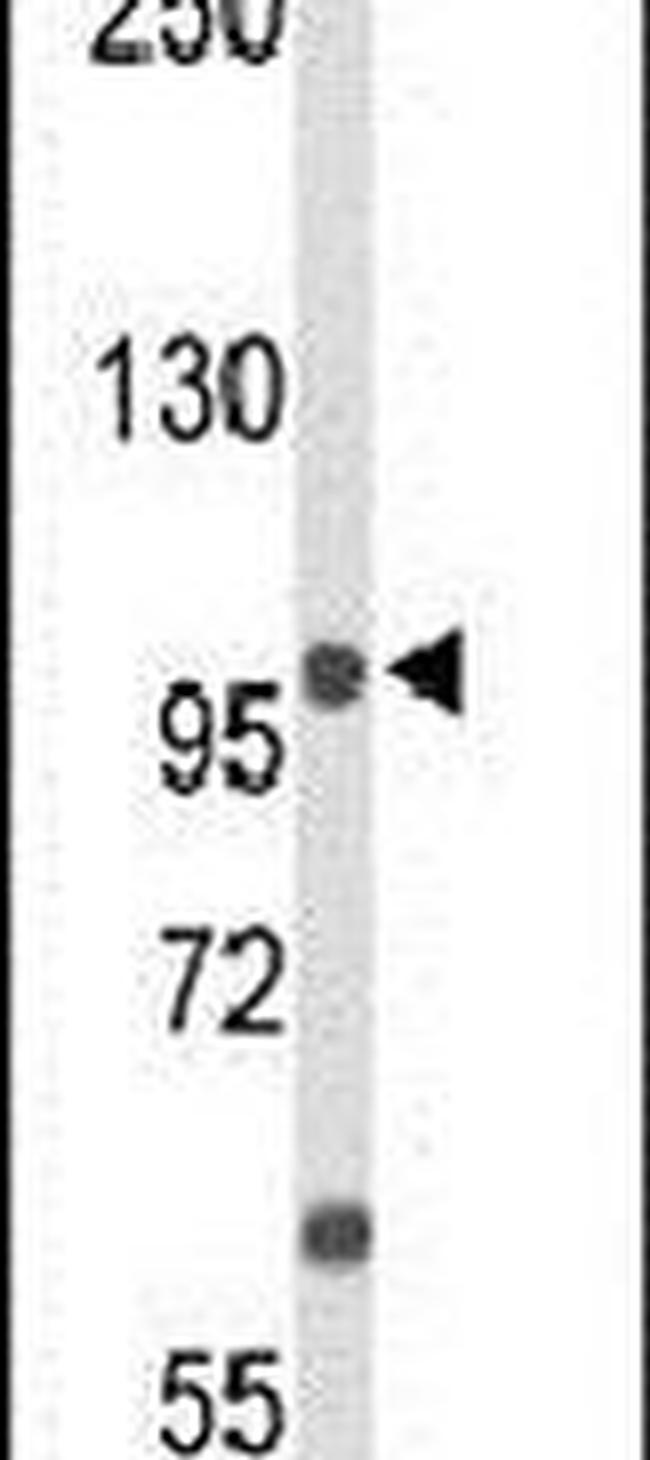 ANO7 Antibody in Western Blot (WB)