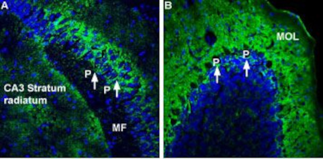 Alpha 2 Na+/K+ ATPase Antibody in Immunohistochemistry (Frozen) (IHC (F))