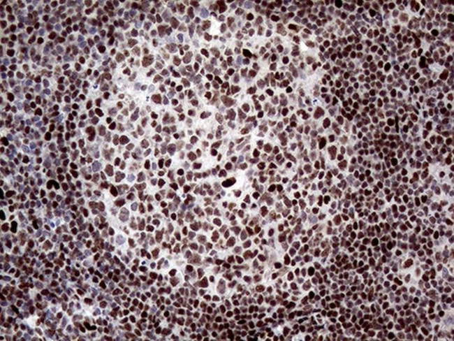 ANP32C Antibody in Immunohistochemistry (Paraffin) (IHC (P))