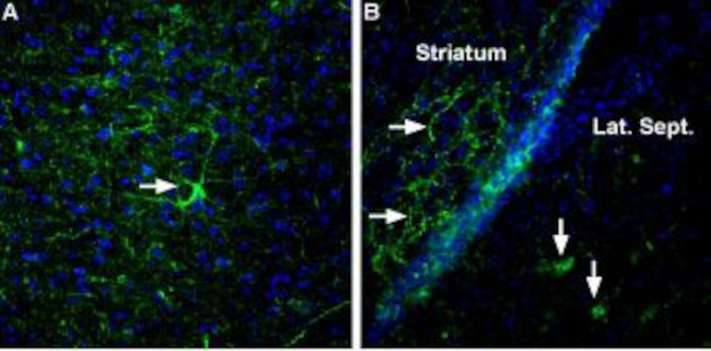 Neurexin 3 alpha (extracellular) Antibody in Immunohistochemistry (IHC)