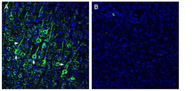 N-Cadherin Antibody in Immunohistochemistry (Frozen) (IHC (F))