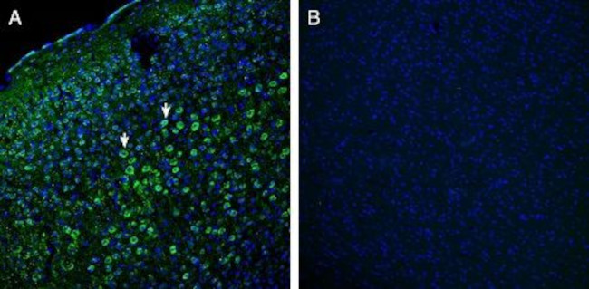 Robo1 (extracellular) Antibody in Immunohistochemistry (Frozen) (IHC (F))