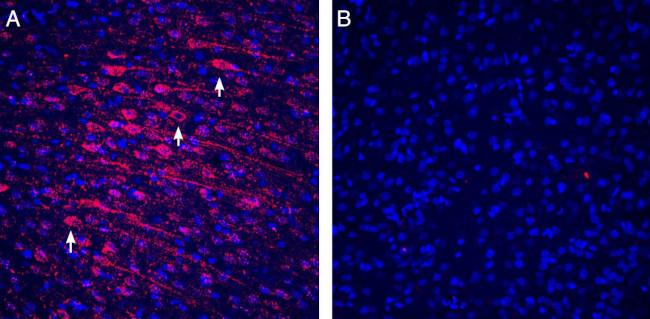 Tetraspanin-3 (extracellular) Antibody in Immunohistochemistry (Frozen) (IHC (F))