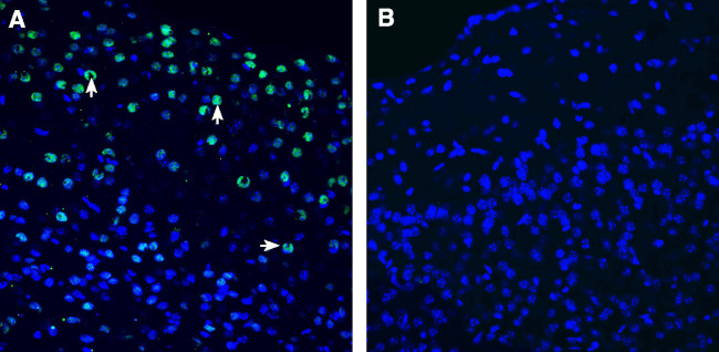 Neuronal Pentraxin 2 (NPTX2) Antibody in Immunohistochemistry (Frozen) (IHC (F))